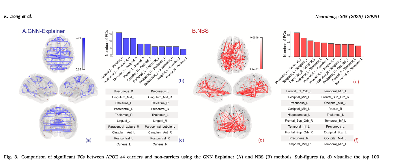 APOE epsilon4 and functional connectivity in AD